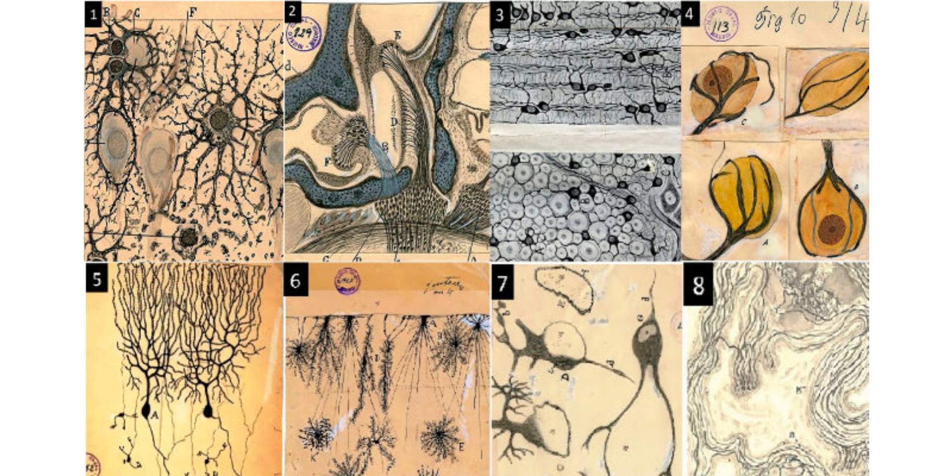 EXPOSICIÓN 'ENTENDER EL CEREBRO: CÓMO ACTÚA LA NEUROPSICOLOGÍA'